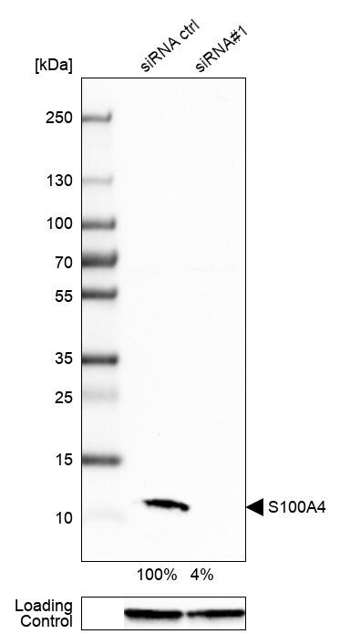 S100A4 Antibody (CL0239) - Azide and BSA Free Western Blot: S100A4 Antibody [NBP3-43988]