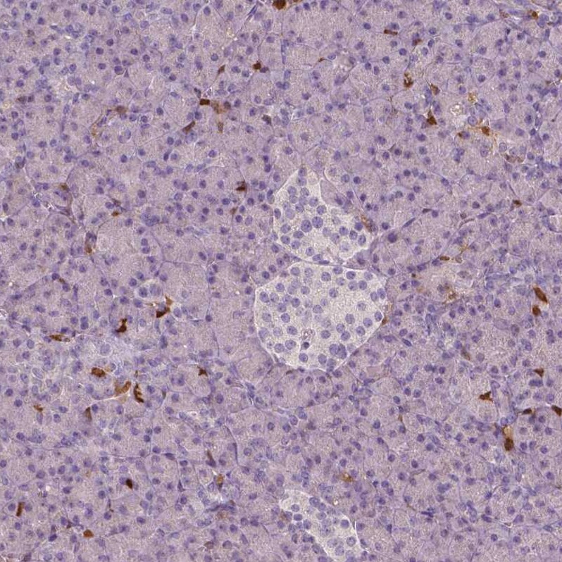 S100A4 Antibody (CL0239) - Azide and BSA Free Immunohistochemistry-Paraffin: S100A4 Antibody [NBP3-43988]