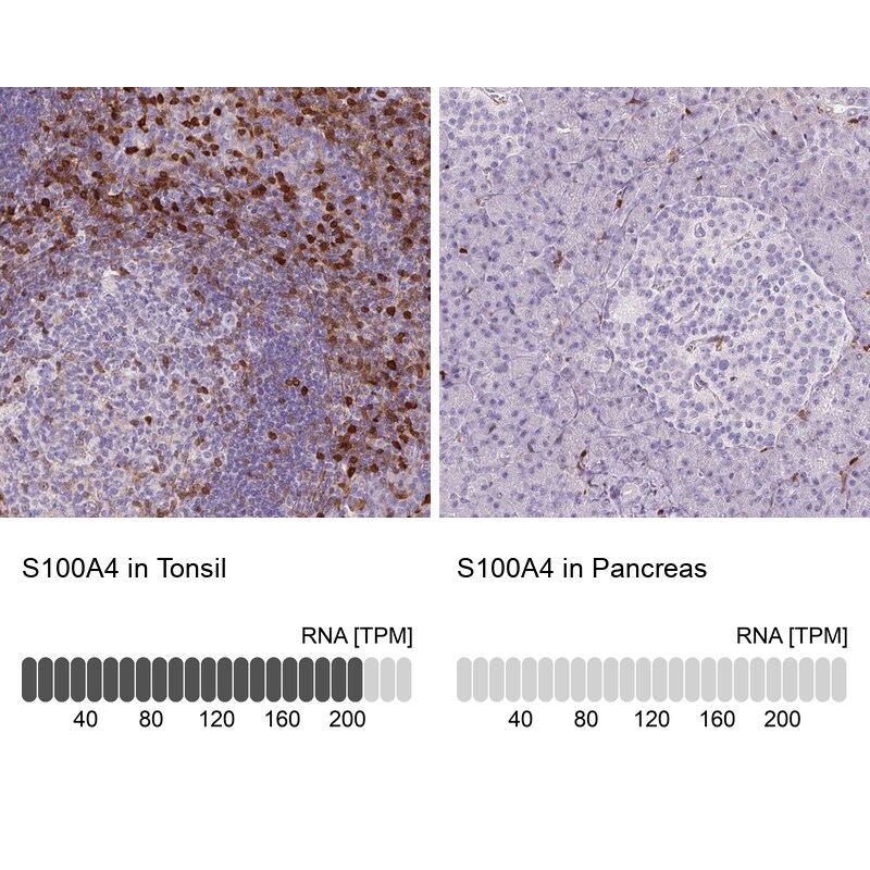 S100A4 Antibody (CL0240) - Azide and BSA Free Immunohistochemistry-Paraffin: S100A4 Antibody [NBP3-43989]