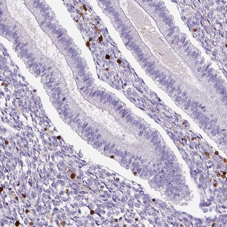 S100A4 Antibody (CL0240) - Azide and BSA Free Immunohistochemistry-Paraffin: S100A4 Antibody [NBP3-43989]