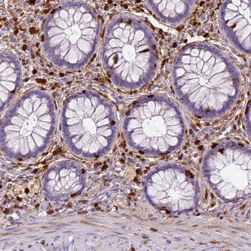 S100A4 Antibody (CL0240) - Azide and BSA Free Immunohistochemistry-Paraffin: S100A4 Antibody [NBP3-43989]