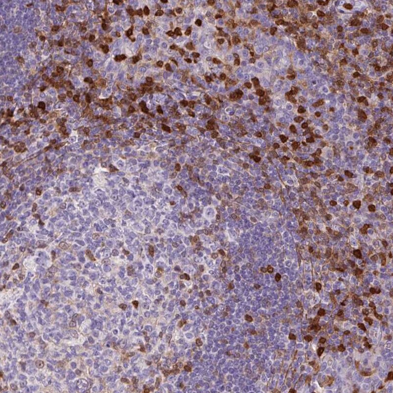 S100A4 Antibody (CL0240) - Azide and BSA Free Immunohistochemistry-Paraffin: S100A4 Antibody [NBP3-43989]
