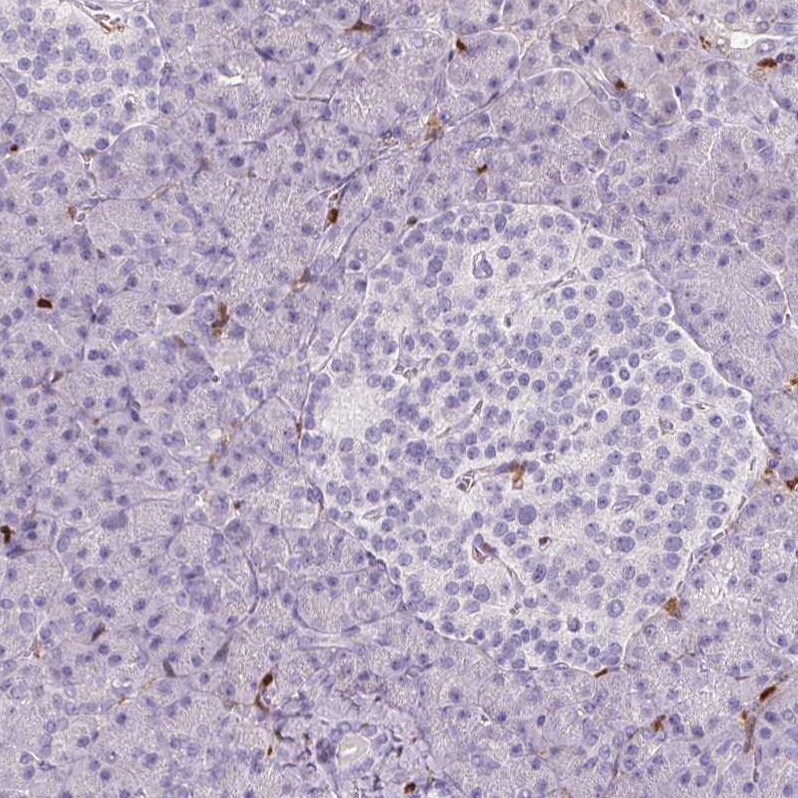 S100A4 Antibody (CL0240) - Azide and BSA Free Immunohistochemistry-Paraffin: S100A4 Antibody [NBP3-43989]