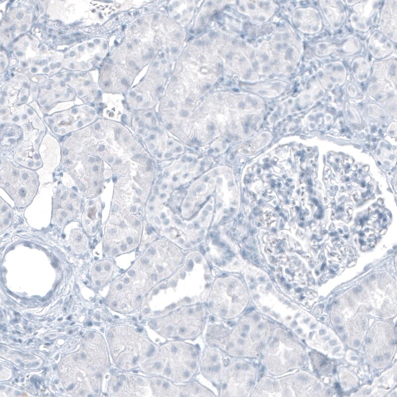 Cytokeratin 20 Antibody (CL9390) - Azide and BSA Free Immunohistochemistry-Paraffin: Cytokeratin 20 Antibody [NBP3-43990]