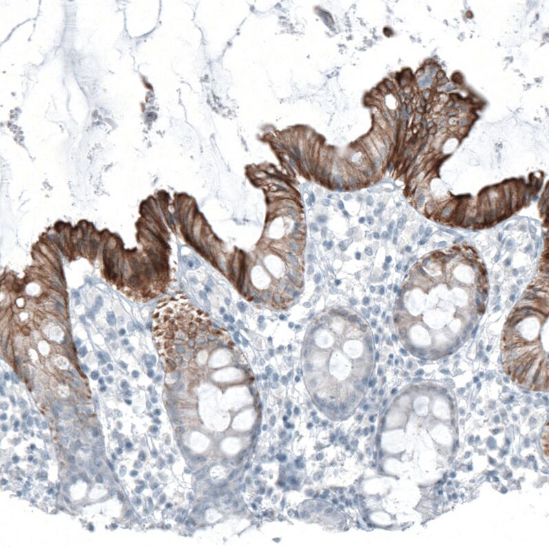 Cytokeratin 20 Antibody (CL9390) - Azide and BSA Free Immunohistochemistry-Paraffin: Cytokeratin 20 Antibody [NBP3-43990]
