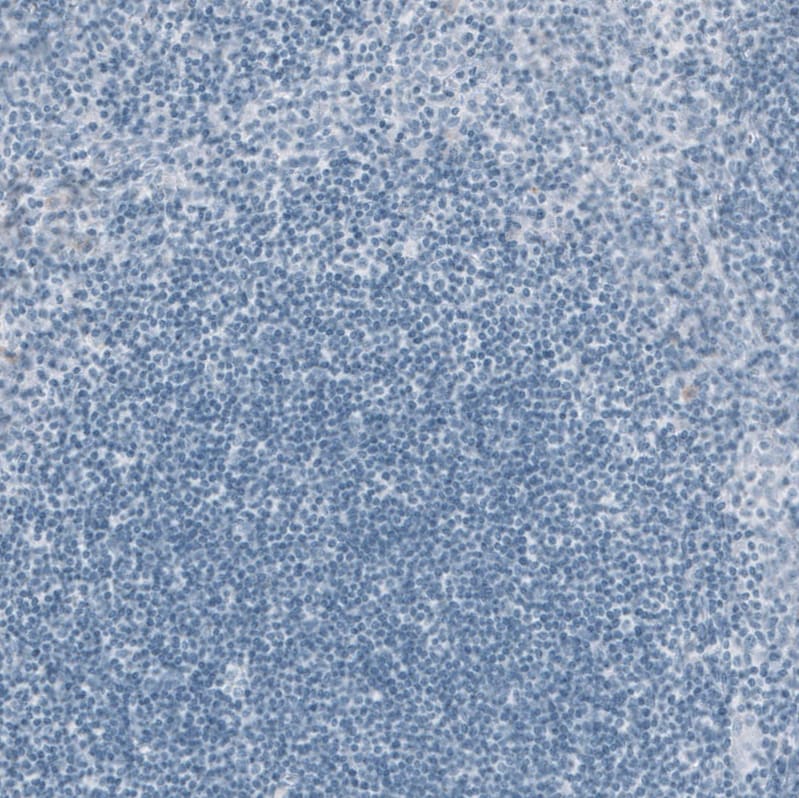 Cytokeratin 20 Antibody (CL9390) - Azide and BSA Free Immunohistochemistry-Paraffin: Cytokeratin 20 Antibody [NBP3-43990]