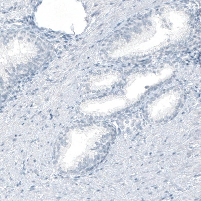 Cytokeratin 20 Antibody (CL9390) - Azide and BSA Free Immunohistochemistry-Paraffin: Cytokeratin 20 Antibody [NBP3-43990]