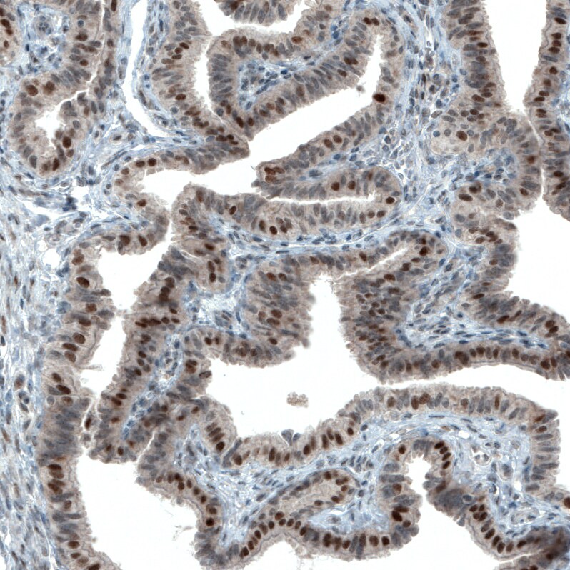 ATF3 Antibody (CL1685) - Azide and BSA Free Immunohistochemistry-Paraffin: ATF3 Antibody [NBP3-43991]