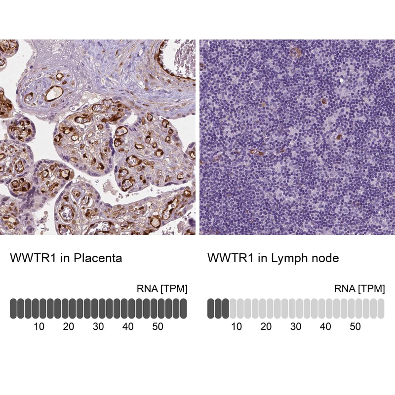 TAZ/WWTR1 Antibody (CL0371) - Azide and BSA Free Immunohistochemistry-Paraffin: TAZ/WWTR1 Antibody [NBP3-43993]