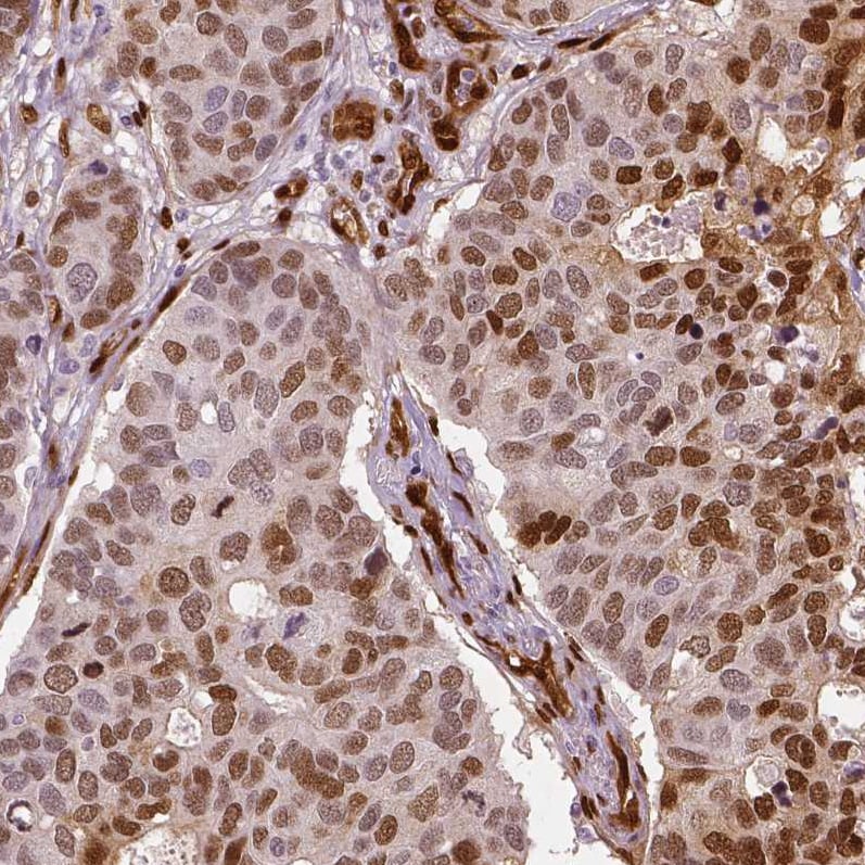 TAZ/WWTR1 Antibody (CL0371) - Azide and BSA Free Immunohistochemistry-Paraffin: TAZ/WWTR1 Antibody [NBP3-43993]