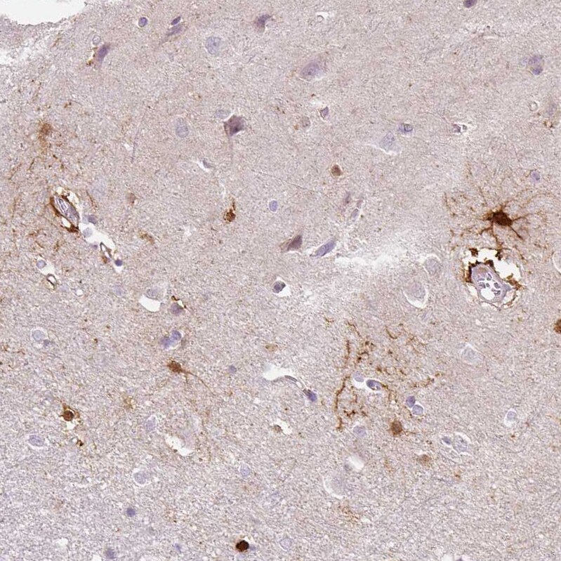 FABP7/B-FABP Antibody (CL0236) - Azide and BSA Free Immunohistochemistry-Paraffin: FABP7/B-FABP Antibody [NBP3-43995]