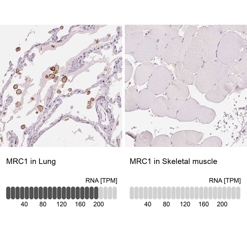 MMR/CD206/Mannose Receptor Antibody (CL0387) - Azide and BSA Free Immunohistochemistry-Paraffin: MMR/CD206/Mannose Receptor Antibody [NBP3-43996]