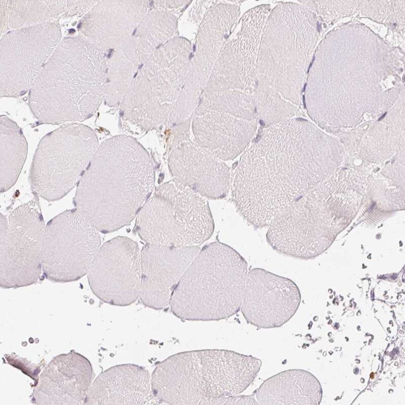 MMR/CD206/Mannose Receptor Antibody (CL0387) - Azide and BSA Free Immunohistochemistry-Paraffin: MMR/CD206/Mannose Receptor Antibody [NBP3-43996]