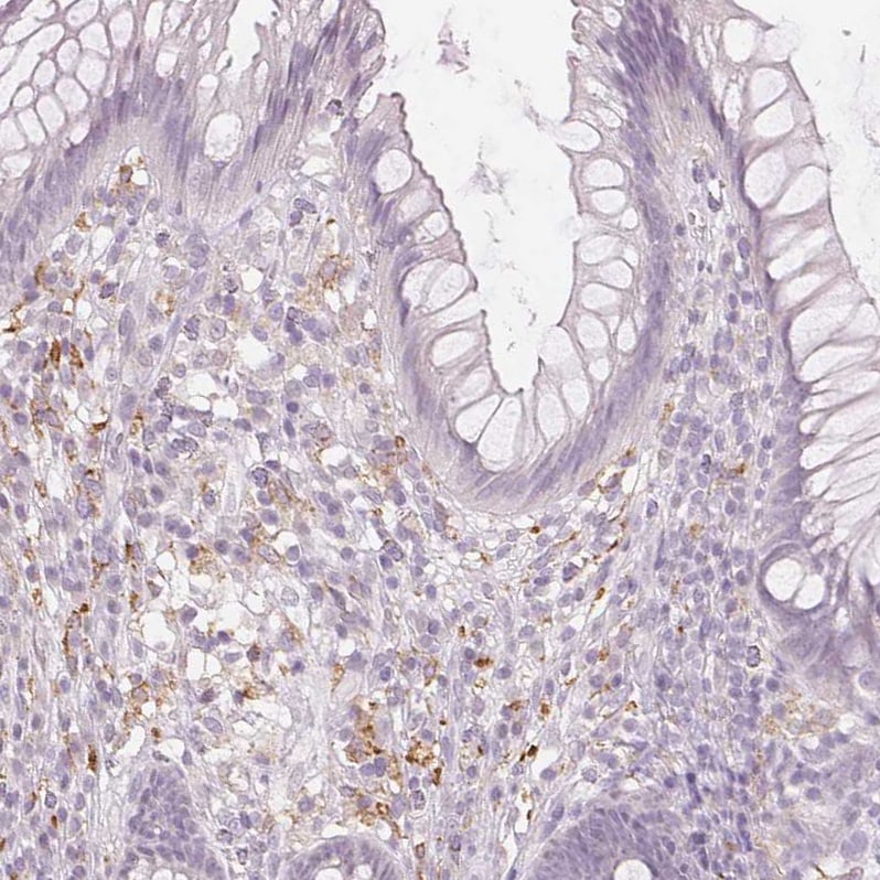 MMR/CD206/Mannose Receptor Antibody (CL0387) - Azide and BSA Free Immunohistochemistry-Paraffin: MMR/CD206/Mannose Receptor Antibody [NBP3-43996]