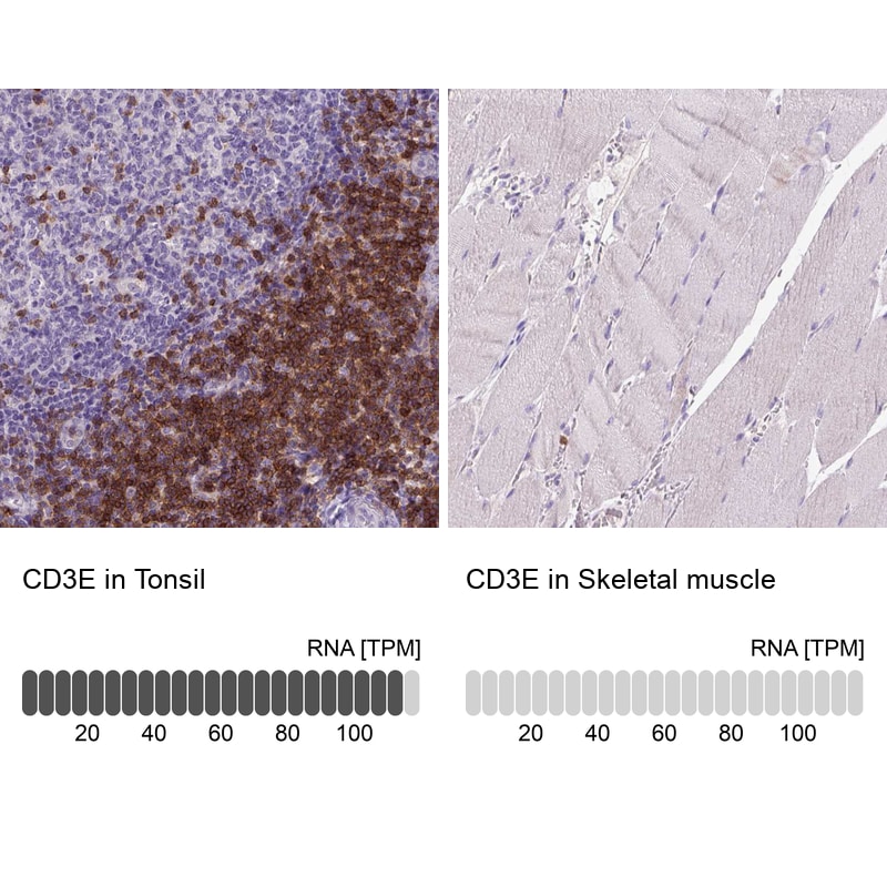 CD3 epsilon Antibody (CL1466) - Azide and BSA Free Immunohistochemistry-Paraffin: CD3 epsilon Antibody [NBP3-43997]