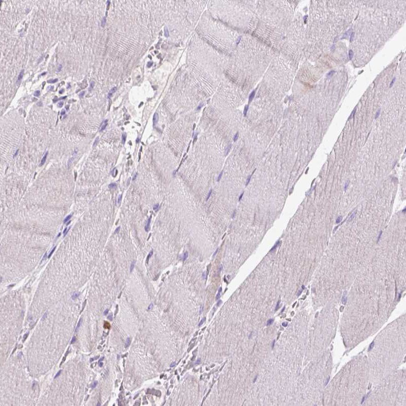 CD3 epsilon Antibody (CL1466) - Azide and BSA Free Immunohistochemistry-Paraffin: CD3 epsilon Antibody [NBP3-43997]