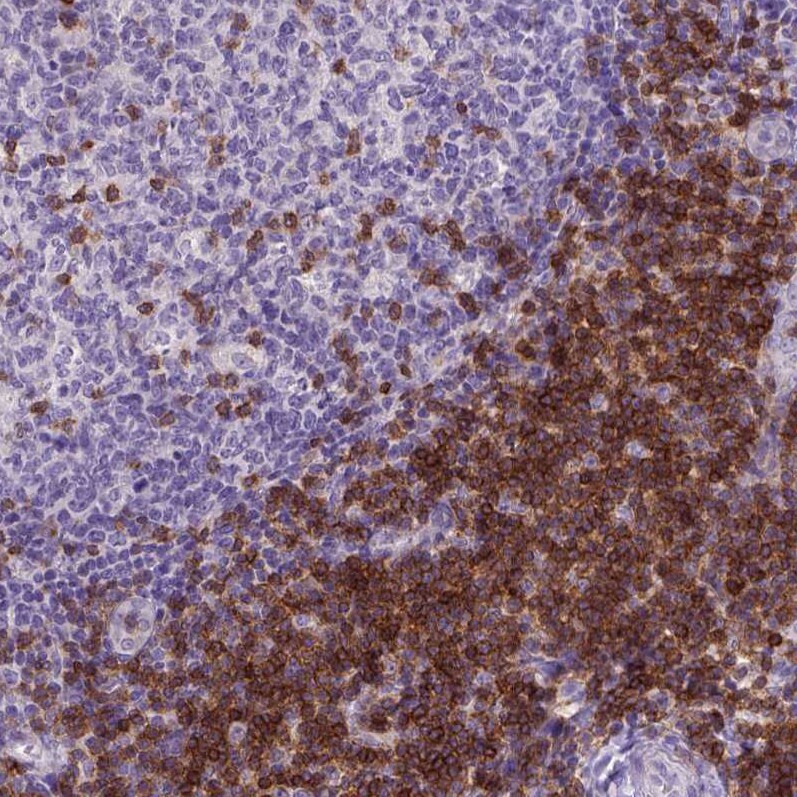 CD3 epsilon Antibody (CL1466) - Azide and BSA Free Immunohistochemistry-Paraffin: CD3 epsilon Antibody [NBP3-43997]