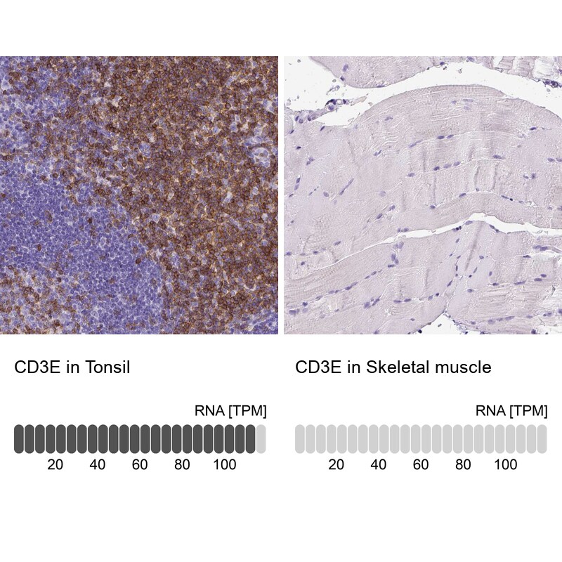 CD3 epsilon Antibody (CL1497) - Azide and BSA Free Immunohistochemistry-Paraffin: CD3 epsilon Antibody [NBP3-43998]