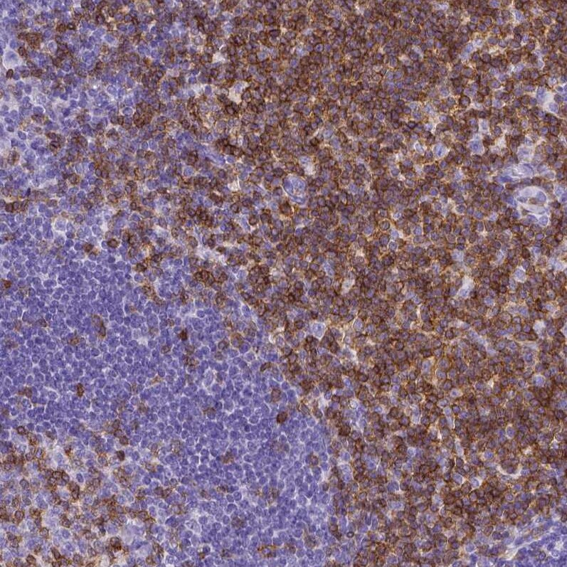 CD3 epsilon Antibody (CL1497) - Azide and BSA Free Immunohistochemistry-Paraffin: CD3 epsilon Antibody [NBP3-43998]