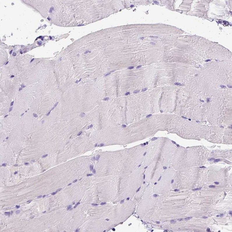 CD3 epsilon Antibody (CL1497) - Azide and BSA Free Immunohistochemistry-Paraffin: CD3 epsilon Antibody [NBP3-43998]