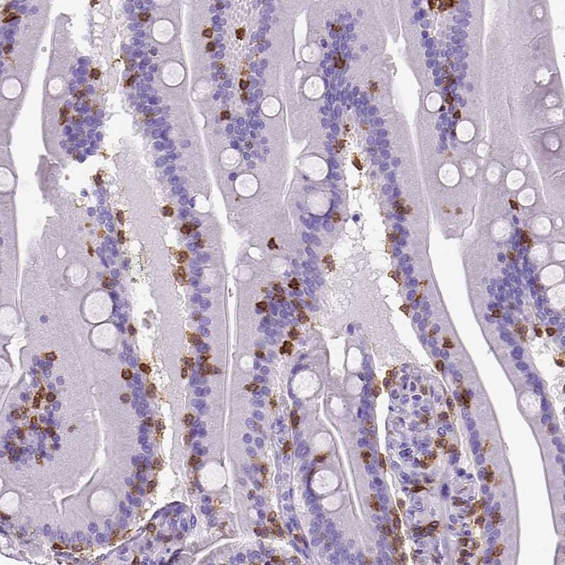 CD3 epsilon Antibody (CL1497) - Azide and BSA Free Immunohistochemistry-Paraffin: CD3 epsilon Antibody [NBP3-43998]