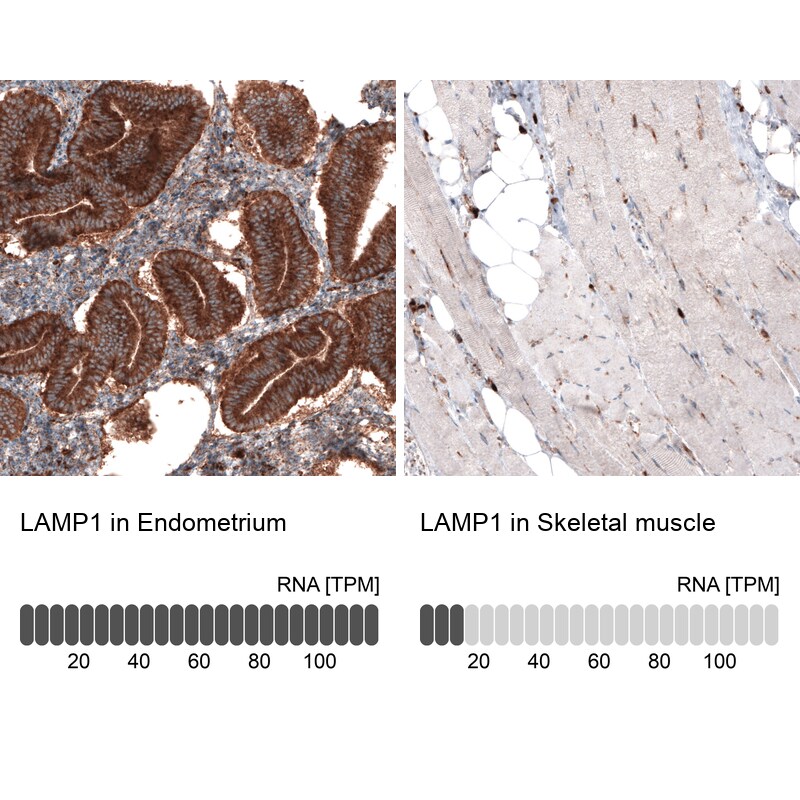LAMP-1/CD107a Antibody (CL3484) - Azide and BSA Free Immunohistochemistry-Paraffin: LAMP-1/CD107a Antibody [NBP3-43999]