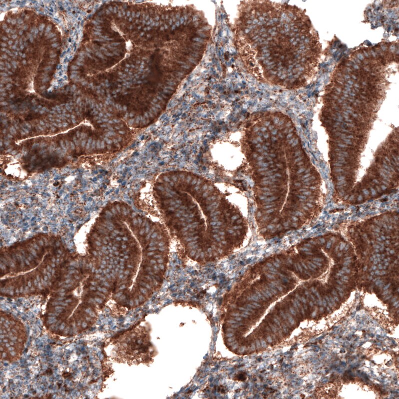 LAMP-1/CD107a Antibody (CL3484) - Azide and BSA Free Immunohistochemistry-Paraffin: LAMP-1/CD107a Antibody [NBP3-43999]