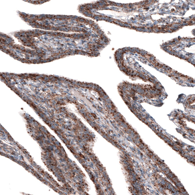 LAMP-1/CD107a Antibody (CL3484) - Azide and BSA Free Immunohistochemistry-Paraffin: LAMP-1/CD107a Antibody [NBP3-43999]