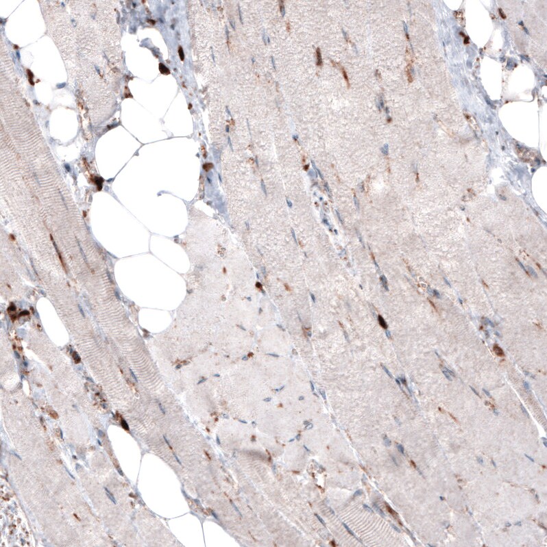 LAMP-1/CD107a Antibody (CL3484) - Azide and BSA Free Immunohistochemistry-Paraffin: LAMP-1/CD107a Antibody [NBP3-43999]