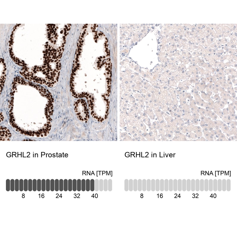 GRHL2 Antibody (CL3760) - Azide and BSA Free Immunohistochemistry-Paraffin: GRHL2 Antibody [NBP3-44000]
