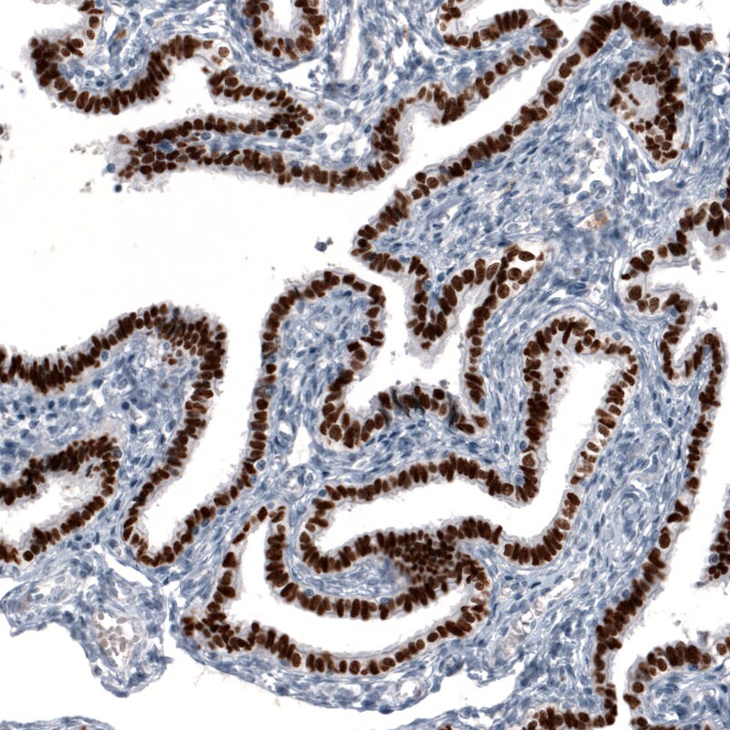 GRHL2 Antibody (CL3760) - Azide and BSA Free Immunohistochemistry-Paraffin: GRHL2 Antibody [NBP3-44000]