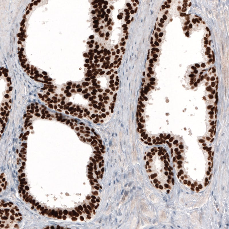 GRHL2 Antibody (CL3760) - Azide and BSA Free Immunohistochemistry-Paraffin: GRHL2 Antibody [NBP3-44000]