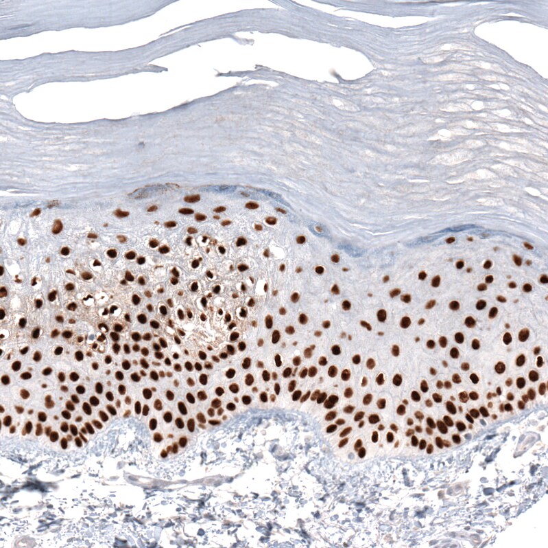 GRHL2 Antibody (CL3760) - Azide and BSA Free Immunohistochemistry-Paraffin: GRHL2 Antibody [NBP3-44000]