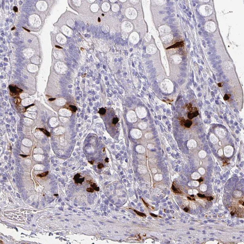 Chromogranin A Antibody (CL0166) - Azide and BSA Free Immunohistochemistry-Paraffin: Chromogranin A Antibody [NBP3-44001]