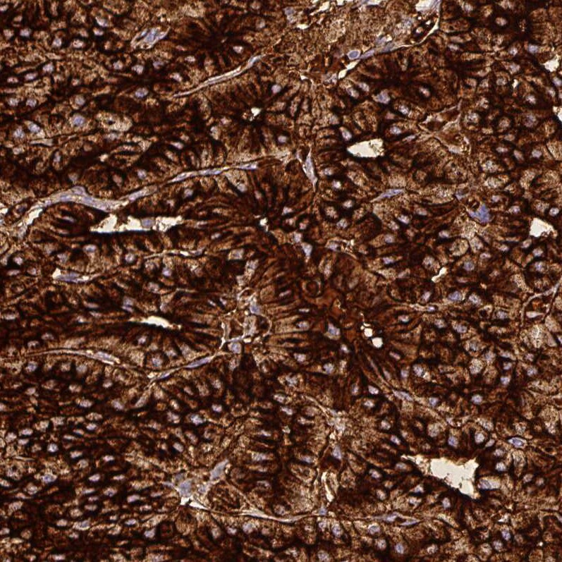 Chromogranin A Antibody (CL0166) - Azide and BSA Free Immunohistochemistry-Paraffin: Chromogranin A Antibody [NBP3-44001]
