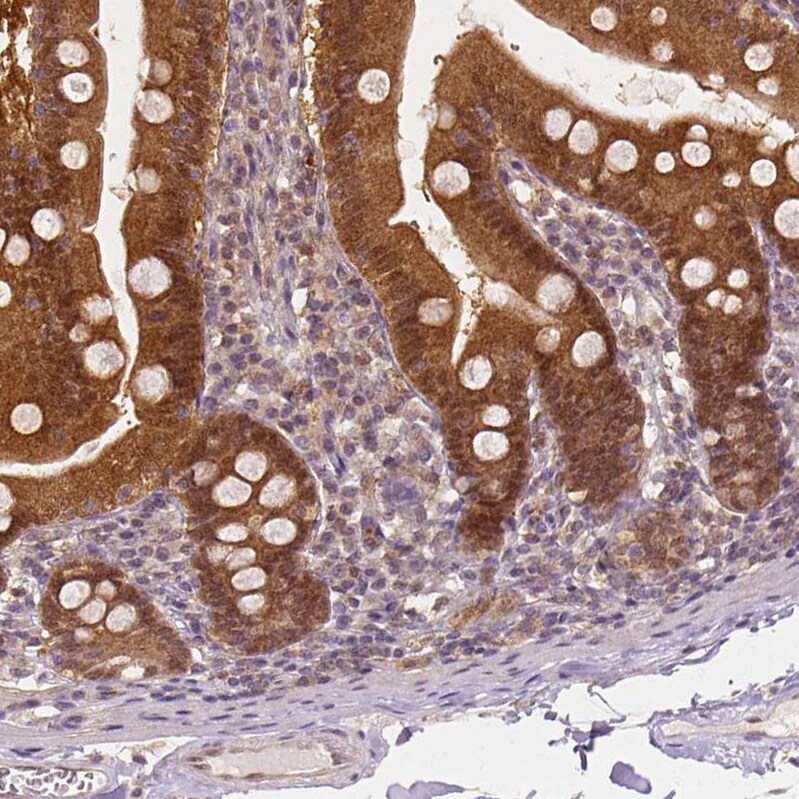 NAPRT1 Antibody (CL0665) - Azide and BSA Free Immunohistochemistry-Paraffin: NAPRT1 Antibody [NBP3-44003]