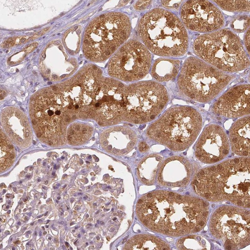 NAPRT1 Antibody (CL0665) - Azide and BSA Free Immunohistochemistry-Paraffin: NAPRT1 Antibody [NBP3-44003]