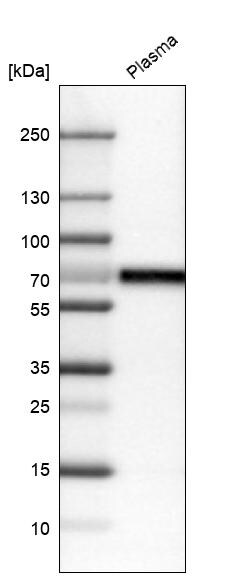 Carnosine Dipeptidase 1/CNDP1 Antibody (CL0339) - Azide and BSA Free Western Blot: Carnosine Dipeptidase 1/CNDP1 Antibody [NBP3-44004]