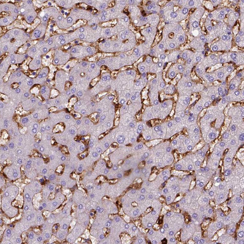 CD14 Antibody (CL1637) - Azide and BSA Free Immunohistochemistry-Paraffin: CD14 Antibody [NBP3-44005]