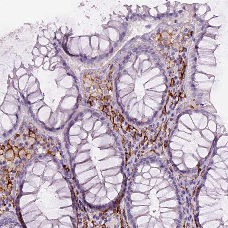 CD14 Antibody (CL1637) - Azide and BSA Free Immunohistochemistry-Paraffin: CD14 Antibody [NBP3-44005]