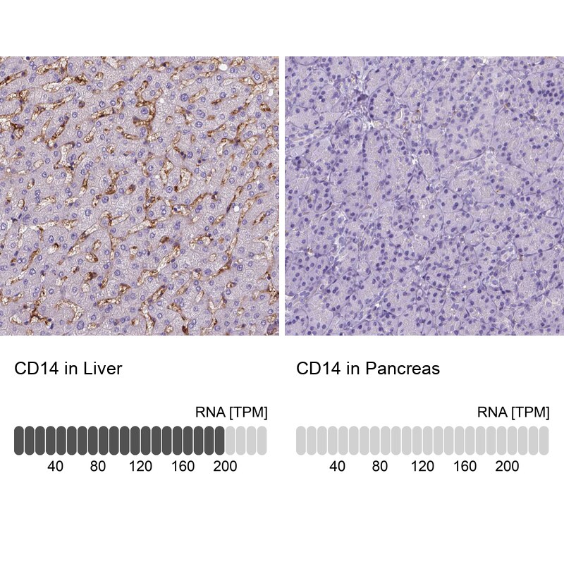 CD14 Antibody (CL1638) - Azide and BSA Free Immunohistochemistry-Paraffin: CD14 Antibody [NBP3-44006]