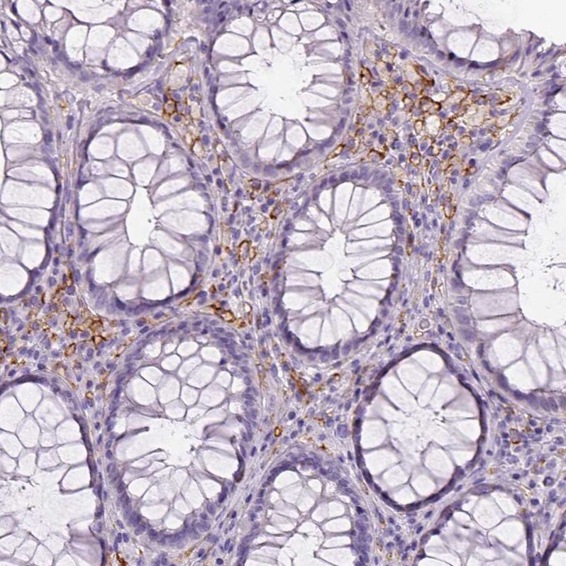 CD14 Antibody (CL1638) - Azide and BSA Free Immunohistochemistry-Paraffin: CD14 Antibody [NBP3-44006]