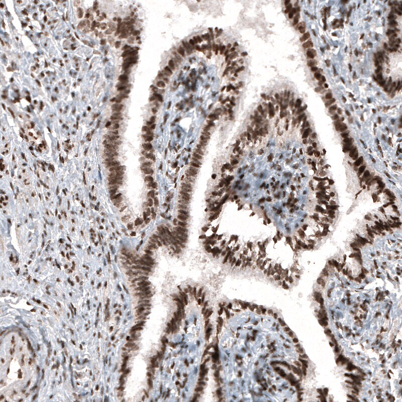 HIST1H3A Antibody (CL4968) - Azide and BSA Free Immunohistochemistry-Paraffin: HIST1H3A Antibody [NBP3-44008]