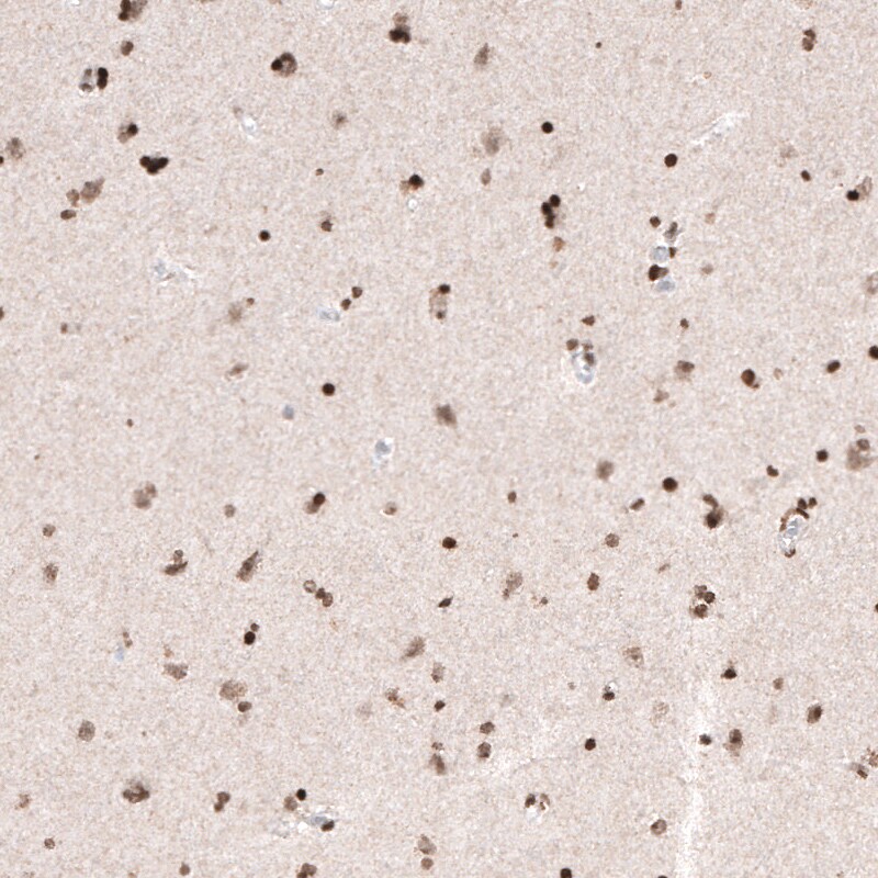 HIST1H3A Antibody (CL4968) - Azide and BSA Free Immunohistochemistry-Paraffin: HIST1H3A Antibody [NBP3-44008]