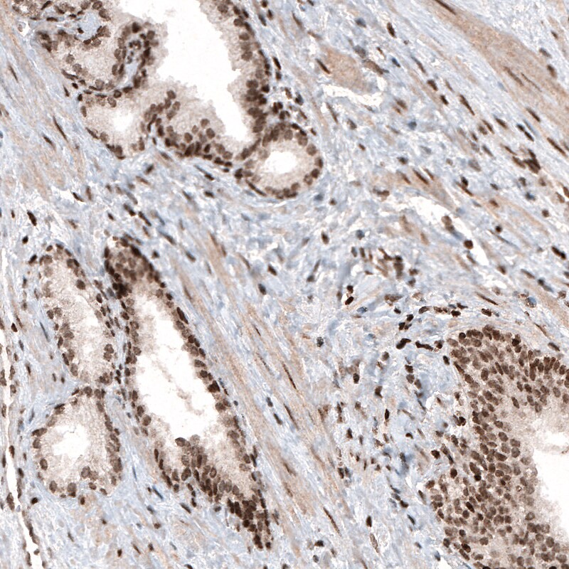 HIST1H3A Antibody (CL4968) - Azide and BSA Free Immunohistochemistry-Paraffin: HIST1H3A Antibody [NBP3-44008]