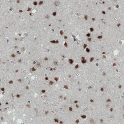 MEF2C Antibody (CL0368) - Azide and BSA Free Immunohistochemistry-Paraffin: MEF2C Antibody [NBP3-44011]