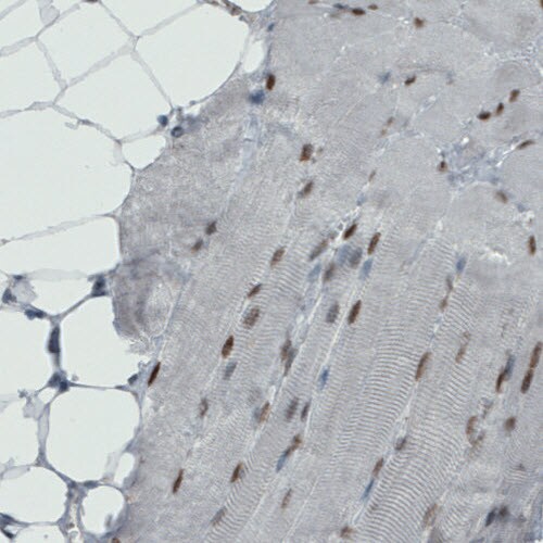 MEF2C Antibody (CL0368) - Azide and BSA Free Immunohistochemistry-Paraffin: MEF2C Antibody [NBP3-44011]