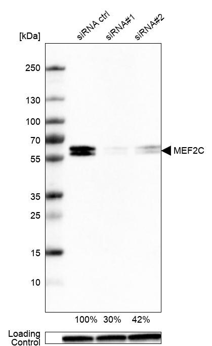 MEF2C Antibody (CL0368) - Azide and BSA Free Western Blot: MEF2C Antibody [NBP3-44011]