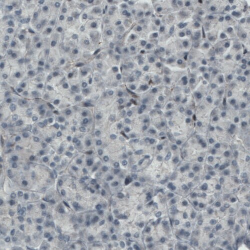 MEF2C Antibody (CL0368) - Azide and BSA Free Immunohistochemistry-Paraffin: MEF2C Antibody [NBP3-44011]