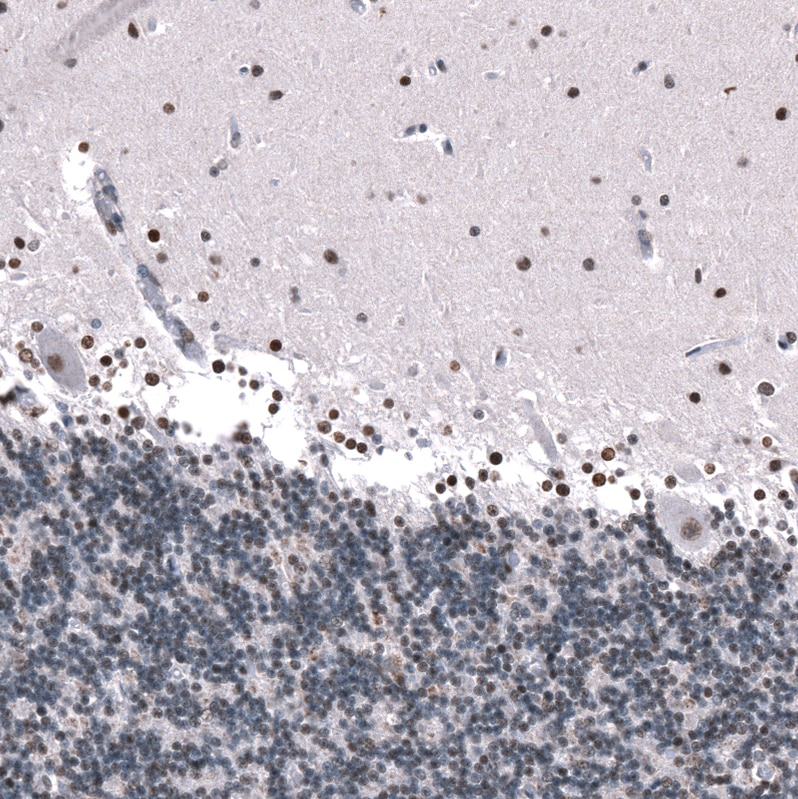 GLI-1 Antibody (CL12193) - Azide and BSA Free Immunohistochemistry-Paraffin: GLI-1 Antibody [NBP3-44013]